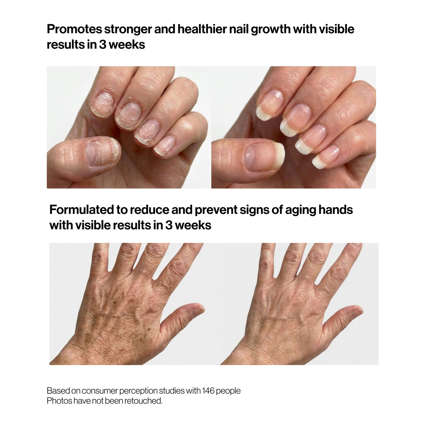 Complete Nail & Hand Care bundle