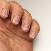 18 day transformation