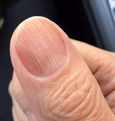 36 day transformation