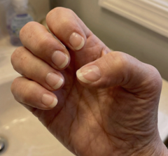 Strengthened my nails at 67