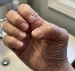 Strengthened my nails at 67