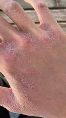 Works great on sensitive skin