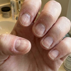 Helped me get rid of ridges