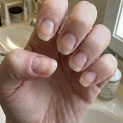 Helped me get rid of ridges